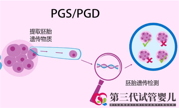 为什么很多人选择去俄罗斯做试管婴儿呢(图1)