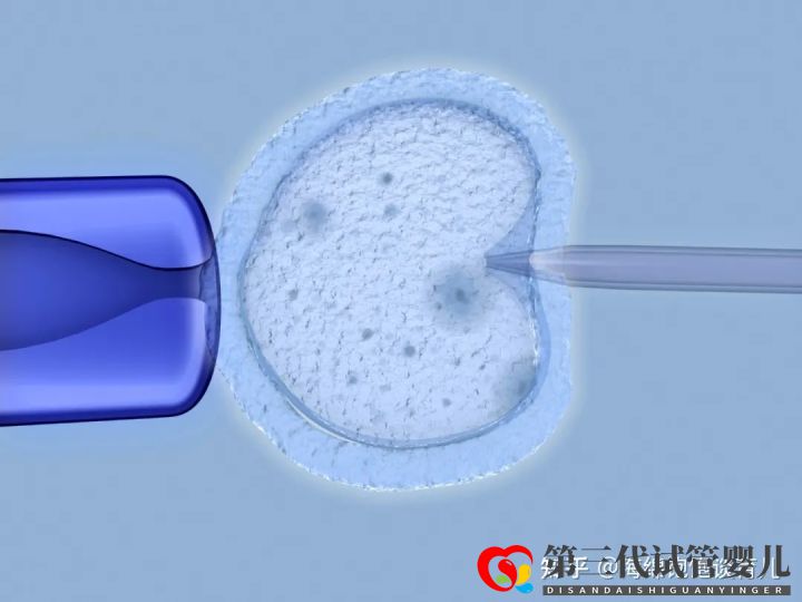 试管婴儿1代、2代、3代、4代哪个最好真实操作过...(图12)