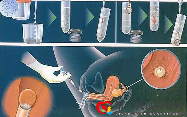 试管真的可以解决怀孕困难吗??试管五点误区快看~(图1) 试管真的可以解决怀孕困难吗??试管五点误区快看~(图1)