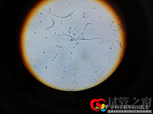 做试管婴儿的全过程做三代试管婴儿预备10万够不够(图8) 做试管婴儿的全过程做三代试管婴儿预备10万够不够(图8)