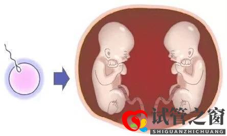 做试管婴儿，一次移植两个生双胞胎好不好？(图3)