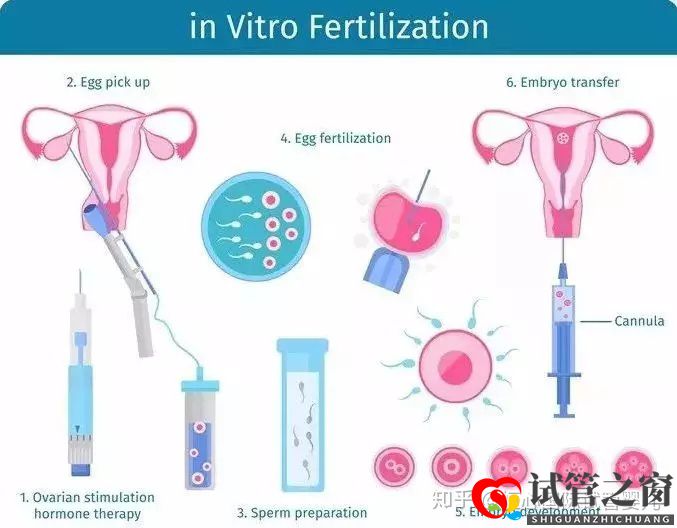 做一个试管婴儿要花多少钱医保能报销吗(图3) 做一个试管婴儿要花多少钱医保能报销吗(图3)