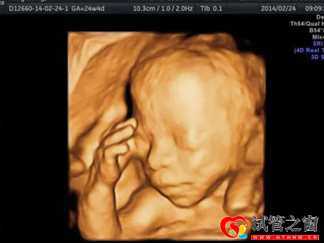 四维检查可以看出胎儿性别
