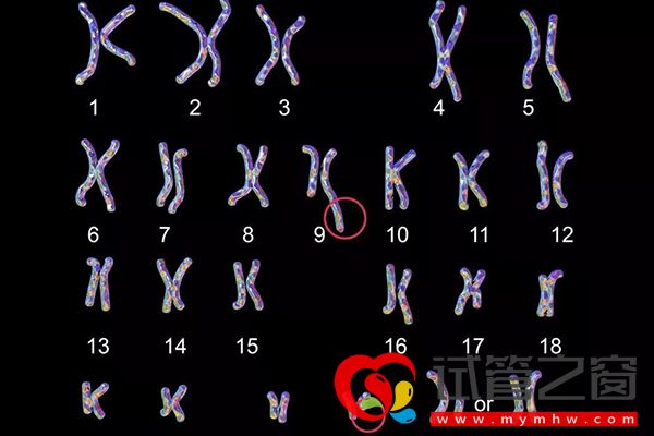 染色体长臂微缺失2.82会有严重后果