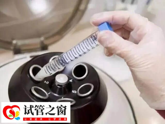 睾丸穿刺前可进行局部麻醉