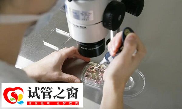 试管降调方案适合高龄女性