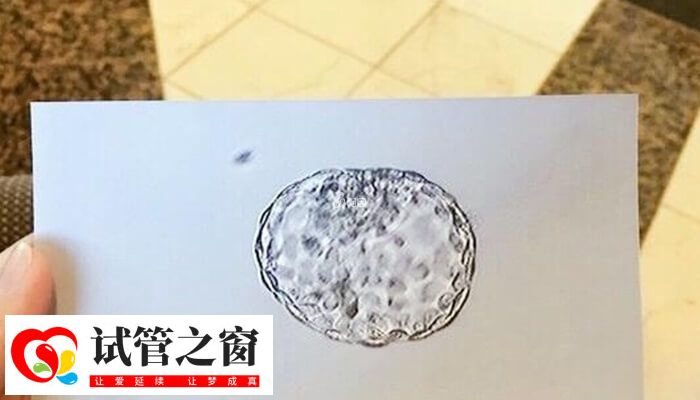 做试管婴儿必须要有可用胚胎