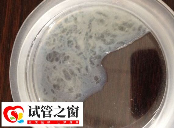 精子活力三级是精子直线前进