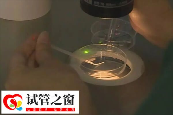 试管取卵过多可能会引起卵巢过度刺激