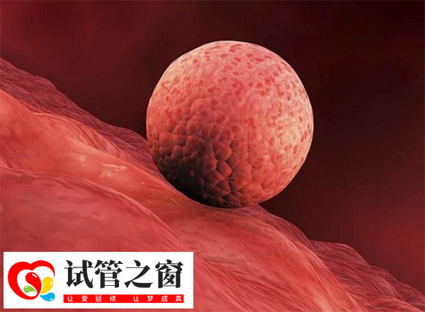 内膜线欠清可能影响试管移植