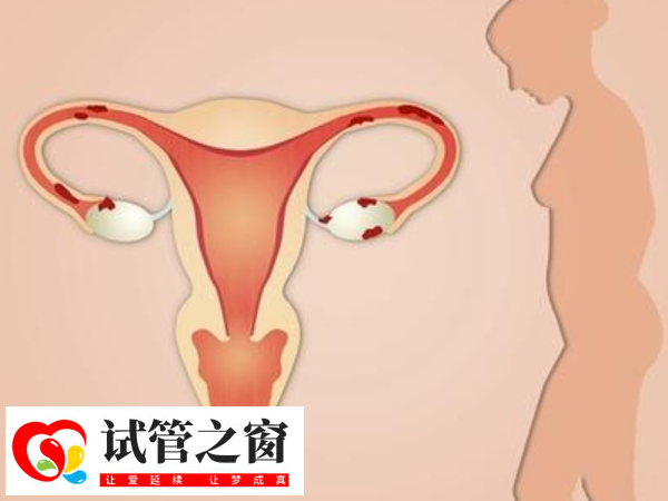 子宫内膜厚度均匀正常