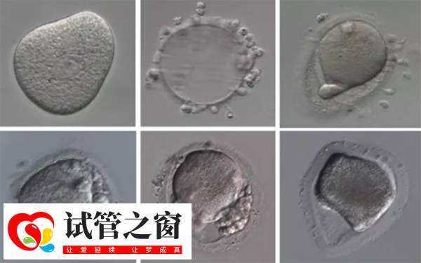 13b内膜做试管囊胚移植成功率在20%-30%