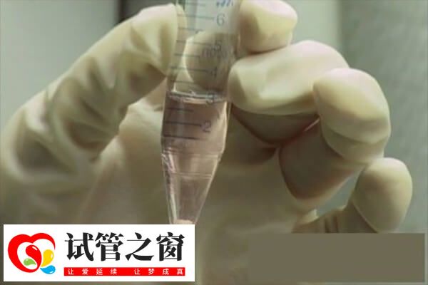 人工授精自然周期无需促排卵治疗