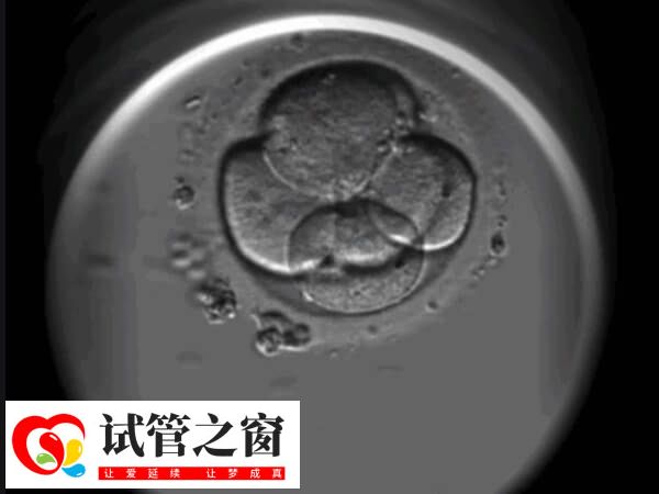 影响试管双胎概率的因素多