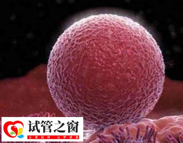 泰国试管婴儿多胎妊娠容易引发早产