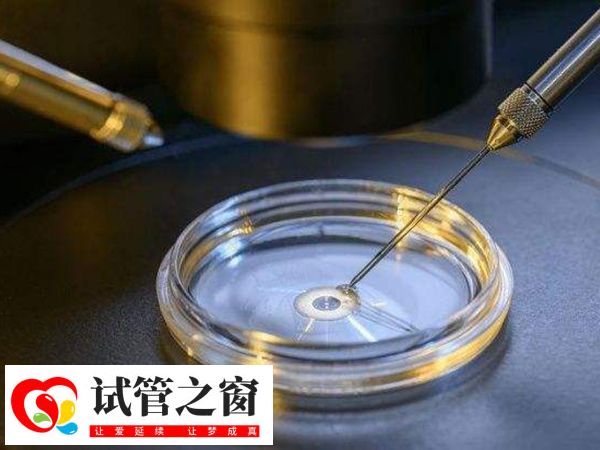 三代试管婴儿涉及多个环节