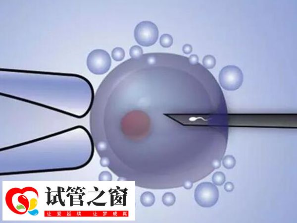 夫妻做三代试管能提高妊娠成功