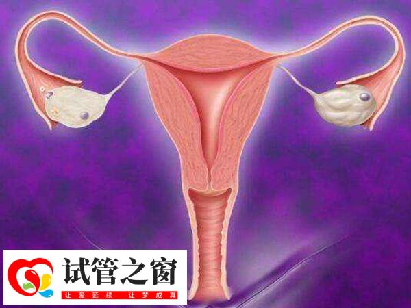试管移植后子宫收缩会引起肚子痛