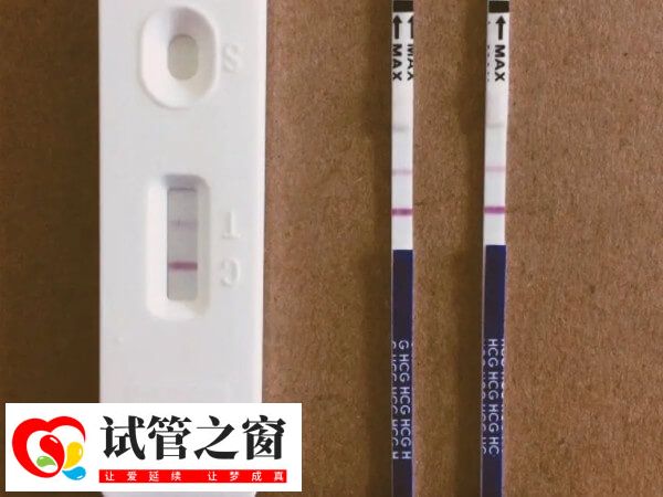 鲜胚移植是试管婴儿中的一种助孕方法