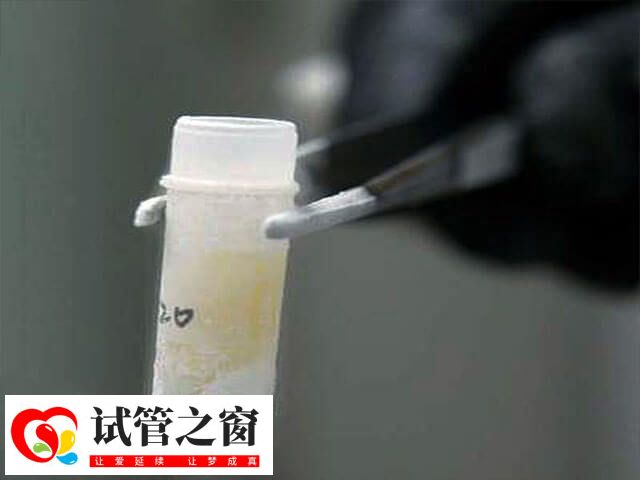 取精是在取精室通过手淫取精