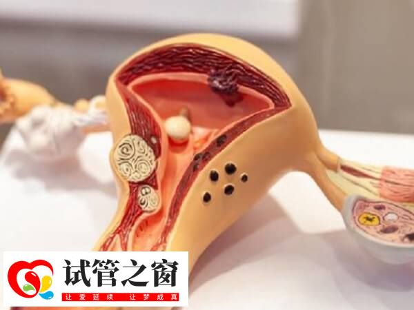 囊胚最晚着床时间在移植7-10天内