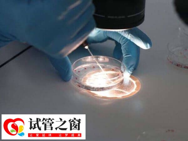 养囊的具体的费用会根据医院收费标准而异