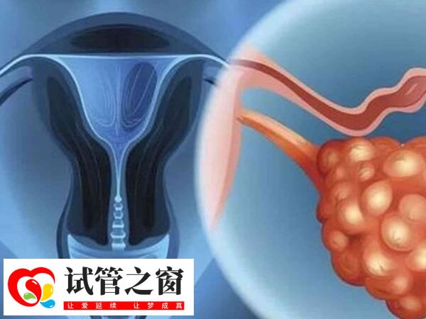 囊胚移植后尿频可能是感染