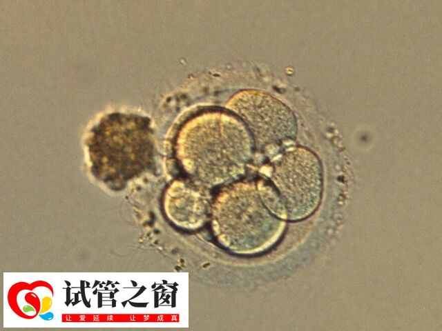 囊胚质量的数字代表发育快慢