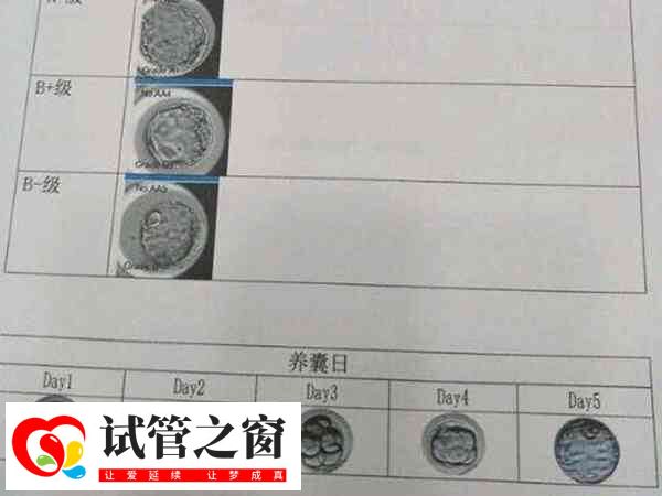 囊胚和冷冻囊胚区别不大
