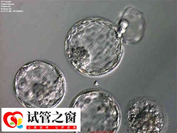 4cb囊胚的4表示在第4阶段的囊胚