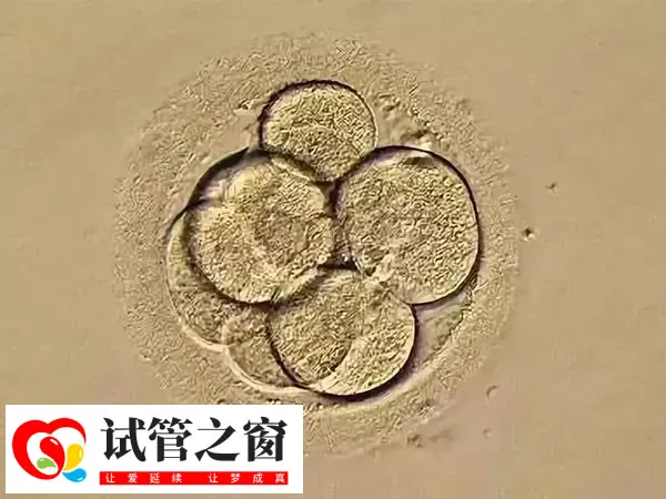 试管移植后拉肚子可能是激素水平变化