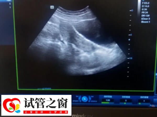 内膜形态异常一般不建议移植鲜胚
