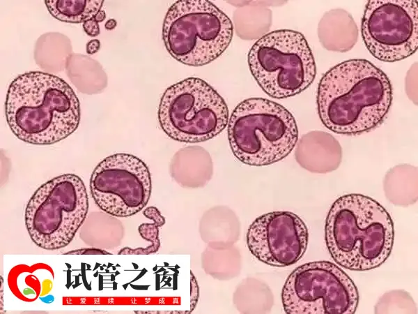免疫系统失调会影响胚胎着床