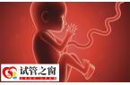试管胚胎移植做二超能不能转产科